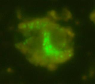 生きる仕組みが不明の微生物(緑色に光る点の部分)=海洋研究開発機構提供 生きる仕組みが不明の微生物(緑色に光る点の部分)=海洋研究開発機構提供