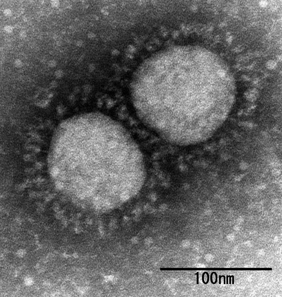新型コロナウイルスの英国型の変異種（国立感染症研究所提供）
