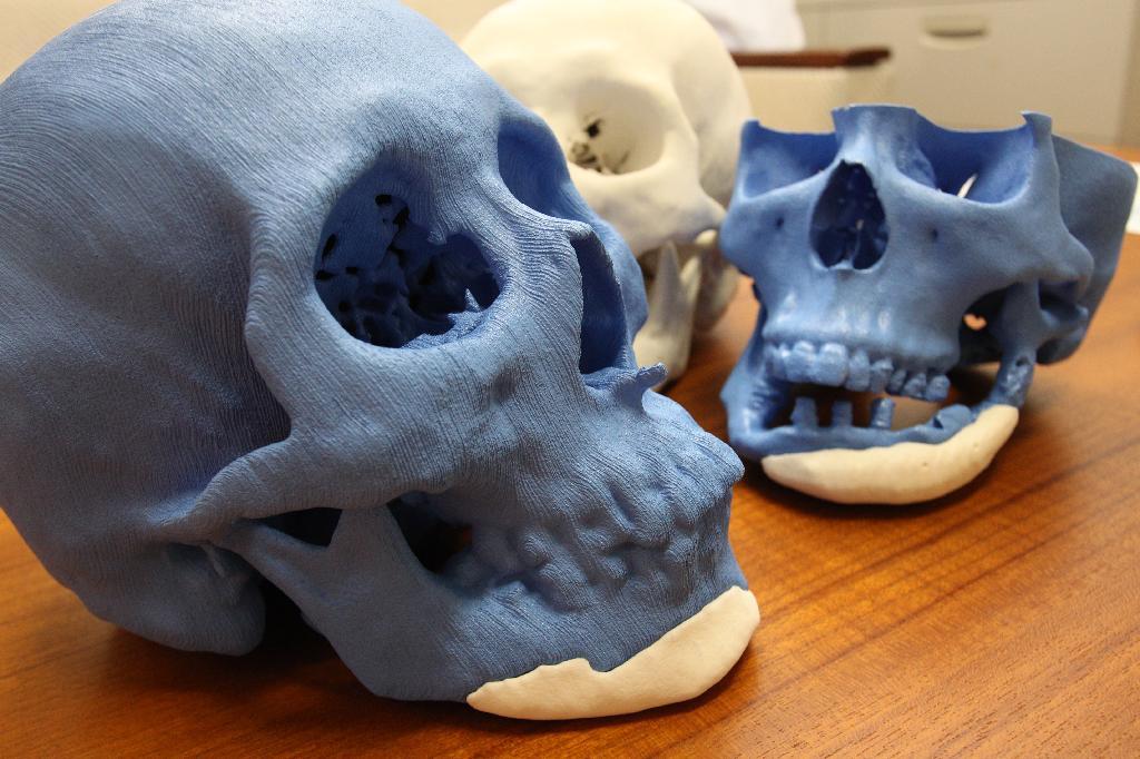 ３Ｄプリンターで作製された頭蓋骨モデル。あご（白色部分）は、後からはめ込んだ人工骨という想定＝東京都文京区の東京大学医学部付属病院（荻窪佳撮影）