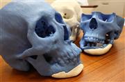 ３Ｄプリンターで作製された頭蓋骨モデル。あご（白色部分）は、後からはめ込んだ人工骨という想定＝東京都文京区の東京大学医学部付属病院（荻窪佳撮影）