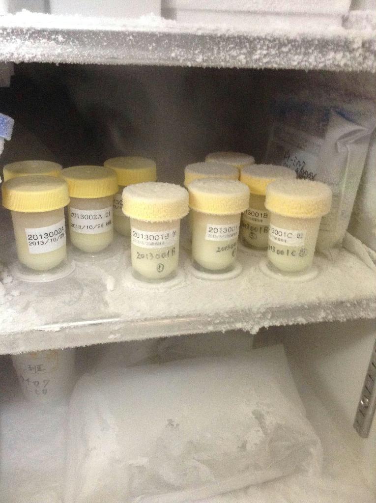 マイナス７０度で保存されているドナーミルク＝東京都品川区の昭和大学病院（平沢裕子撮影）