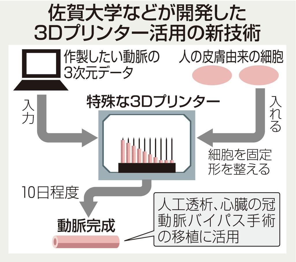佐賀大学などが開発した３Dプリンター活用の新技術