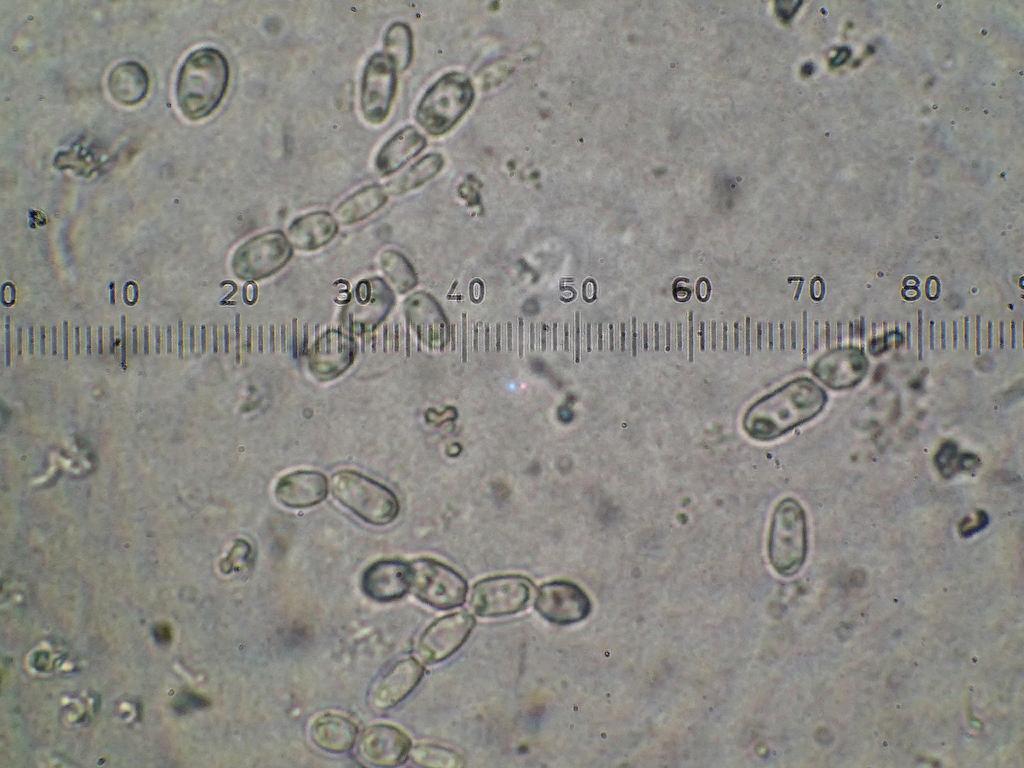 「Ｎｏ．１」の体内から見つかった酵母様真菌の顕微鏡写真（鳥羽水族館提供）