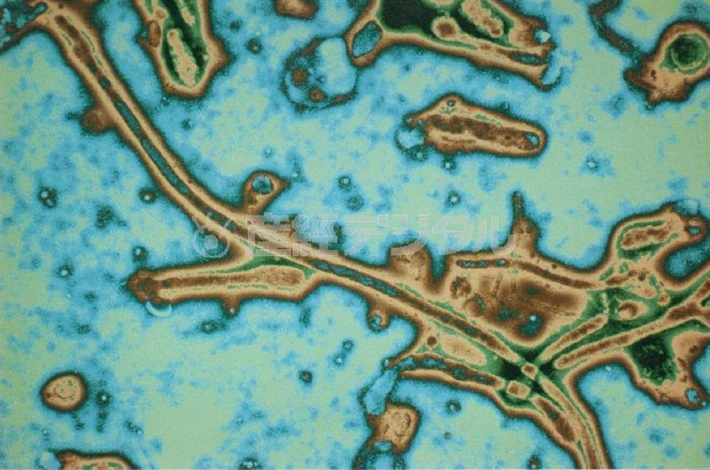 エボラ出血熱ウイルスの電子顕微鏡写真（パリのパスツール研究所提供）