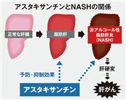 アスタキサンチンとNASH