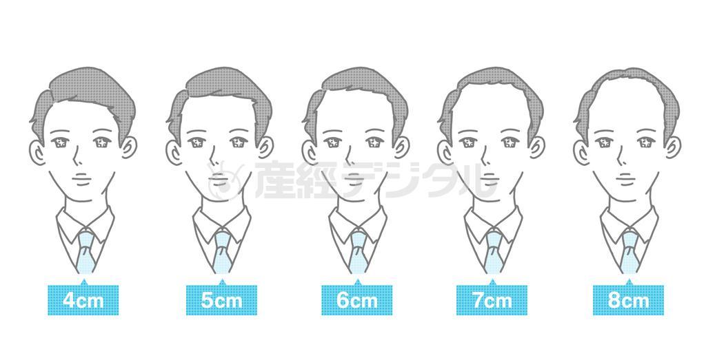 薄毛の境界線として最も多かった回答は「７センチ」となった