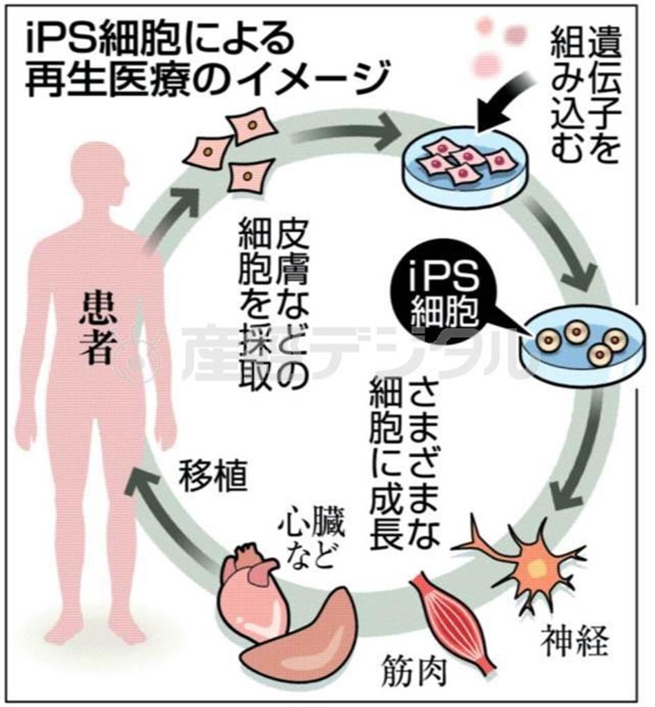 人工多能性幹細胞（ｉＰＳ細胞）による再生医療のイメージ