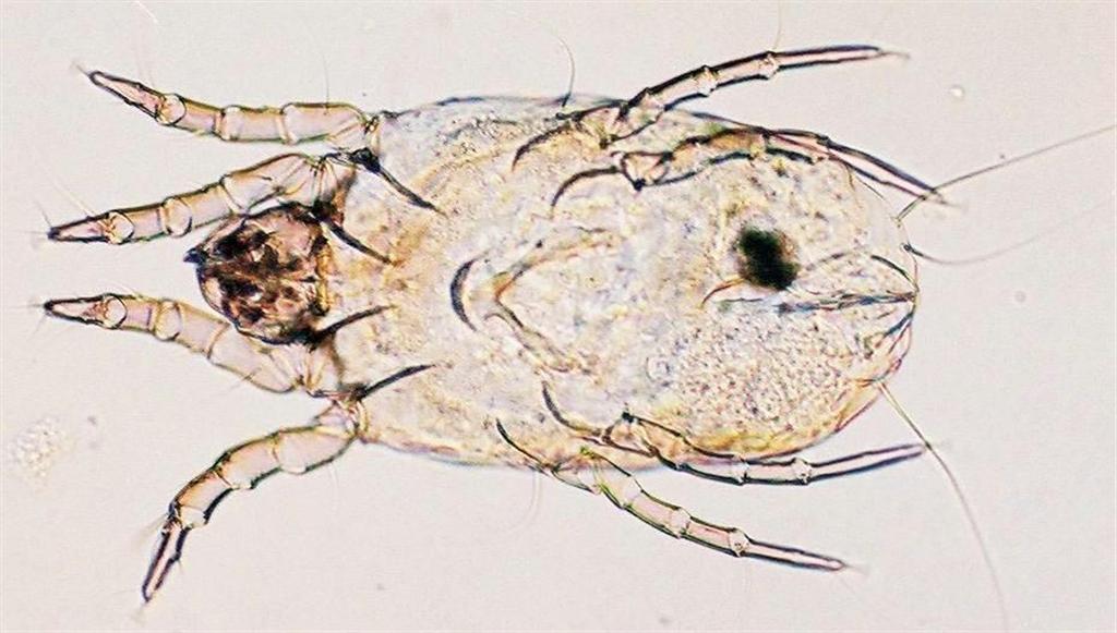 アレルギーの原因となるコナヒョウヒダニ