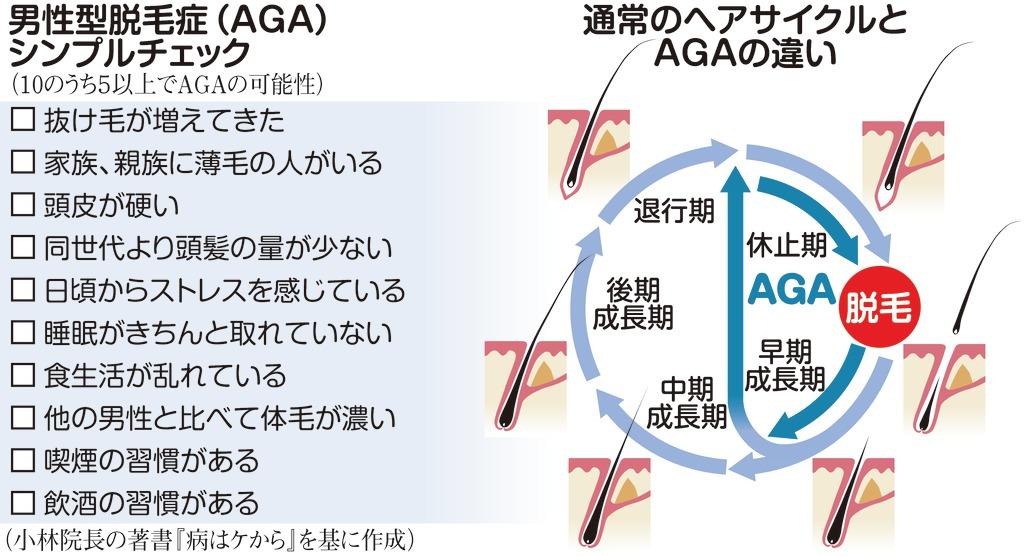 男性型脱毛症チェック