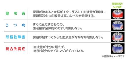 専用装置に表示される脳透過図が問診の補強材料となる（新宿メンタルクリニック提供）
