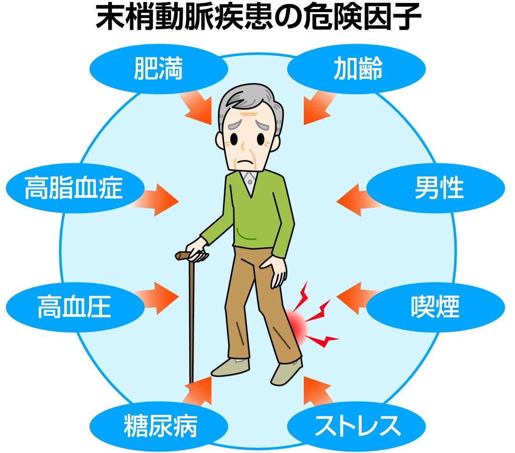末梢動脈疾患のキケン因子