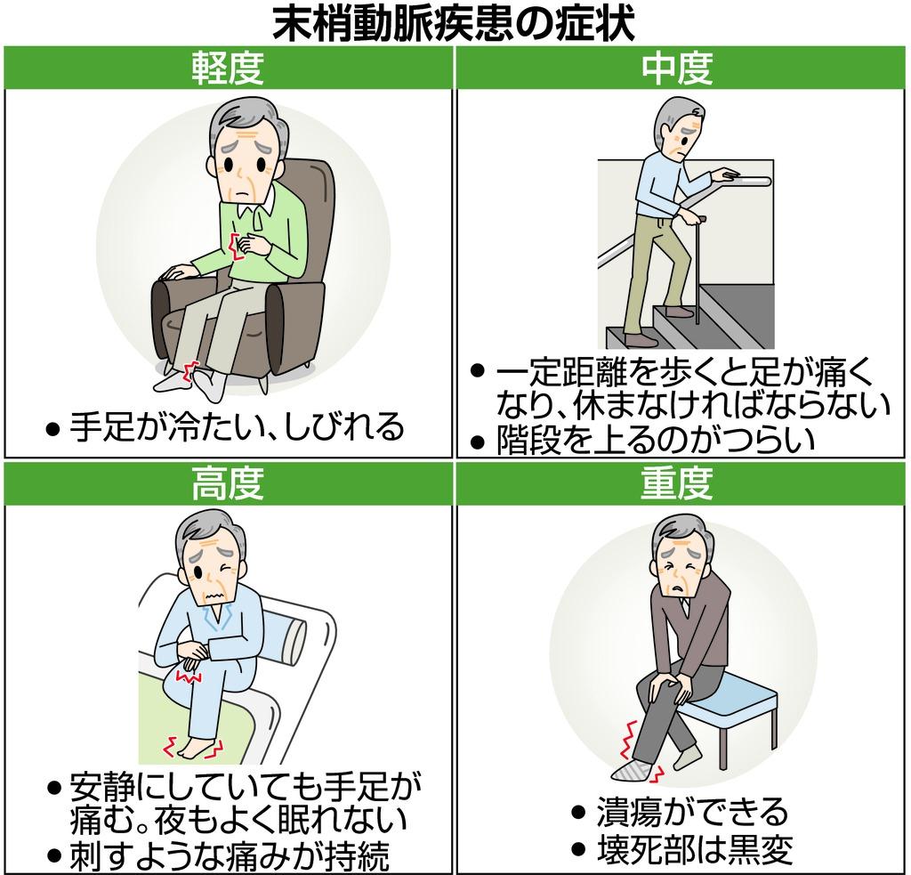末梢動脈疾患の症状