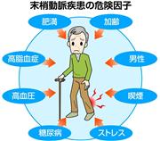 末梢動脈疾患のキケン因子
