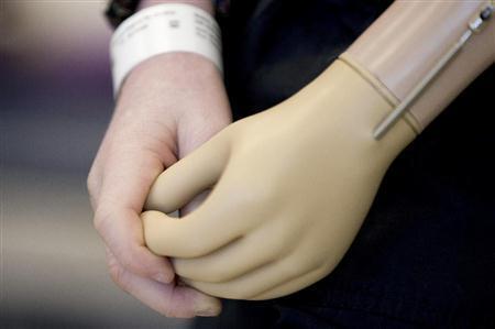 新たな手 で取り戻す触覚 米チーム ロボット義手の開発成功 Sankeibiz サンケイビズ