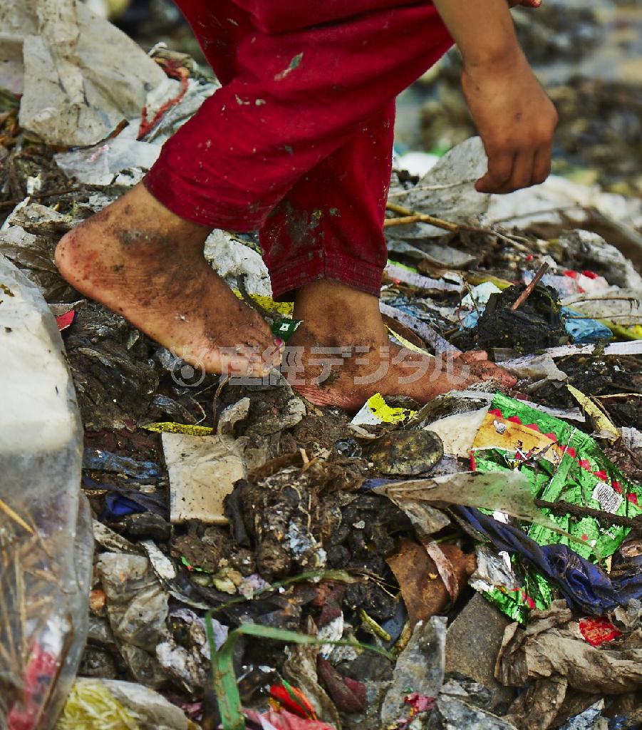 裸足の足には傷が絶えない＝２０１５年７月２９日、バングラデシュ・首都ダッカ（ワールド・ビジョン・ジャパン撮影）