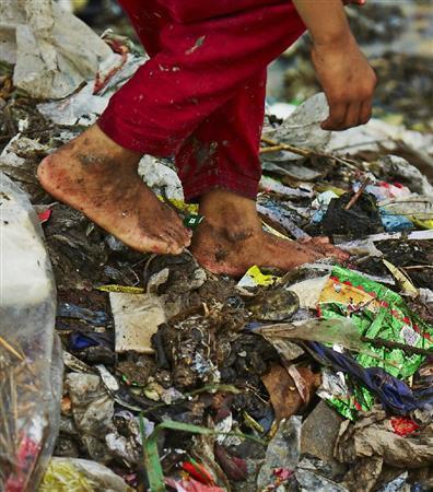 裸足の足には傷が絶えない＝２０１５年７月２９日、バングラデシュ・首都ダッカ（ワールド・ビジョン・ジャパン撮影）