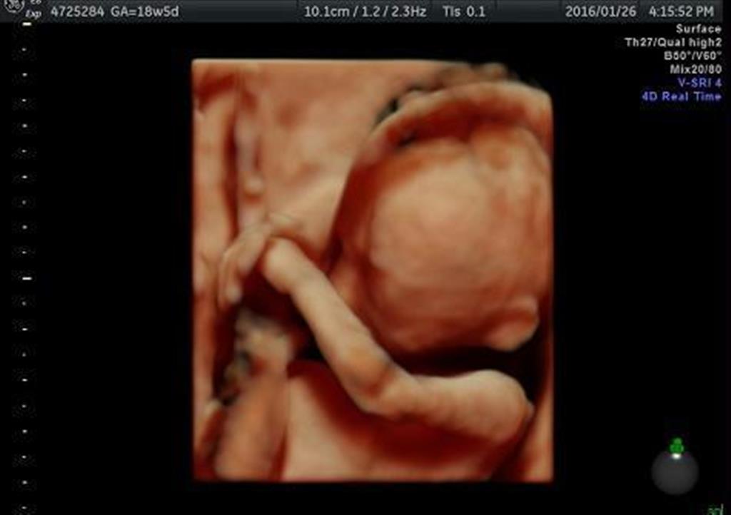 最新の超音波検査機器で撮影された胎児。手の動きなどの様子が鮮明に分かる（ベルランド総合病院提供）