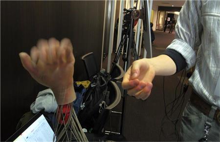 ＭｅｌｔｉｎＭＭＭＩの高機能筋電義手。ケーブルが消えワイヤレスで操作できるようになった