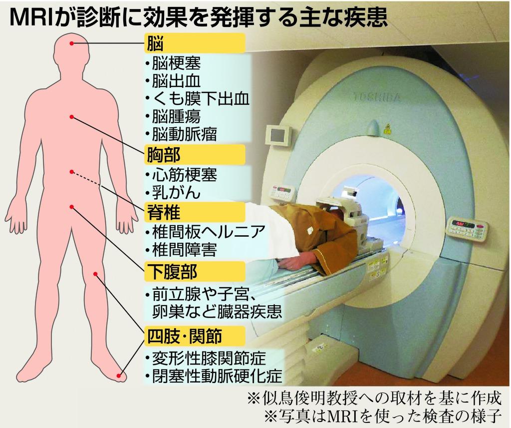 ＭＲＩが診断に効果を発揮する主な疾患
