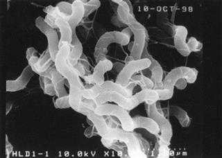 培養されたピロリ菌（浅香正博北海道医療大学長提供）