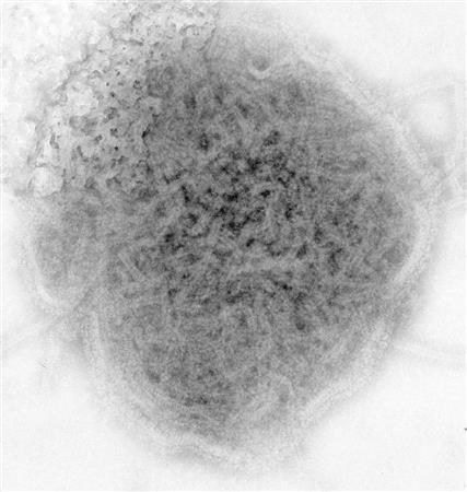 おたふくかぜの原因であるムンプスウイルスの電子顕微鏡画像（米疾病対策センター提供）