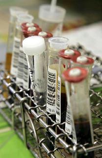 働く外国人への合理的で適正な医療や年金の仕組みが課題だ