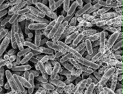 酪酸菌の顕微鏡データ