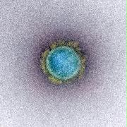 新型コロナウイルス粒子の電子顕微鏡画像（米国立アレルギー・感染症研究所提供）