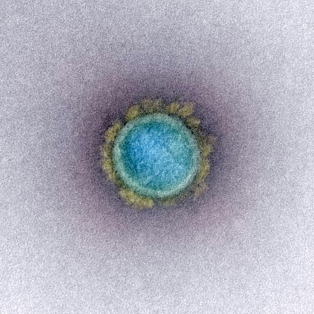 新型コロナウイルス粒子の電子顕微鏡画像（米国立アレルギー・感染症研究所提供）