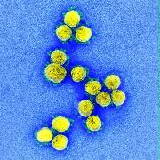 新型コロナウイルスの電子顕微鏡画像（米国立アレルギー・感染症研究所提供）