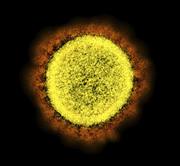 新型コロナウイルスの電子顕微鏡写真（米国立アレルギー感染症研究所提供）