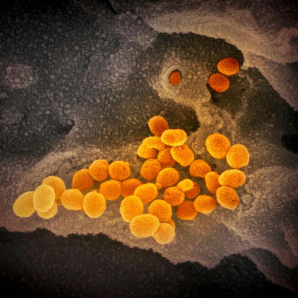 新型コロナウイルス（オレンジ色）の電子顕微鏡画像＝米国立アレルギー・感染症研究所提供
