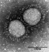 新型コロナウイルスの英国型の変異種（国立感染症研究所提供）