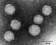 英国に由来する新型コロナウイルスの変異株の電子顕微鏡写真（国立感染症研究所提供）