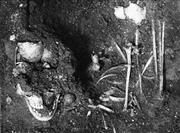 ポリオにかかり、介護を受けて成長したと説明されてきた縄文時代の人骨（北海道洞爺湖町教育委員会提供）